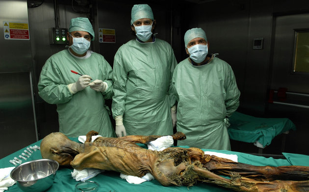 Ötzi