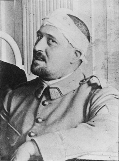 Guillaume Apollinaire 1916 tavaszán, fejsérülése után